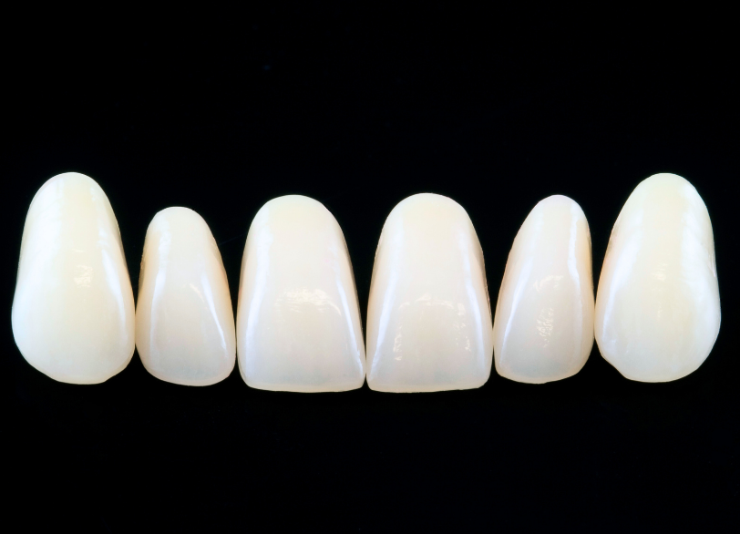 美しさだけではない、機能的な価値【セラミック】|湘南パーク歯科
