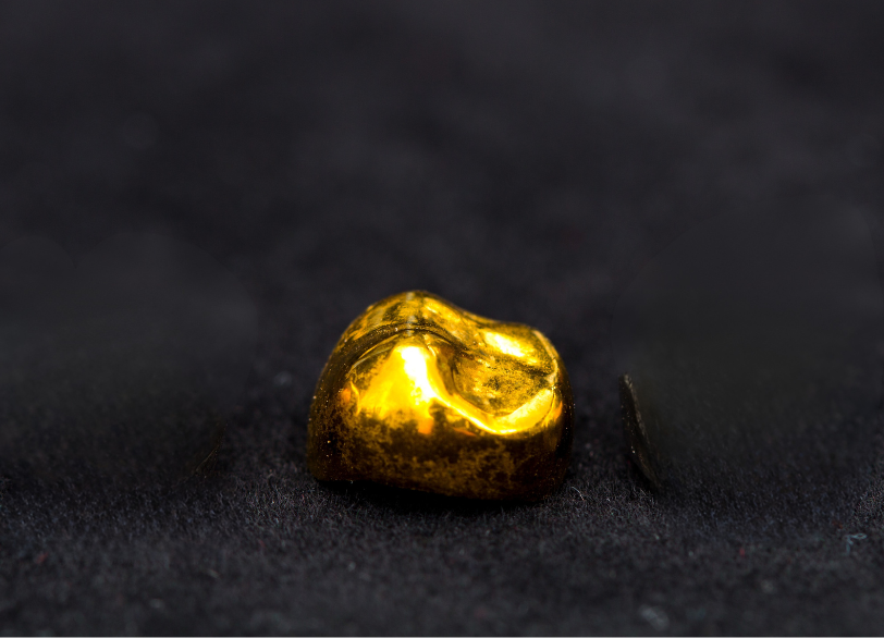 ゴールドクラウン(金合金)|湘南パーク歯科