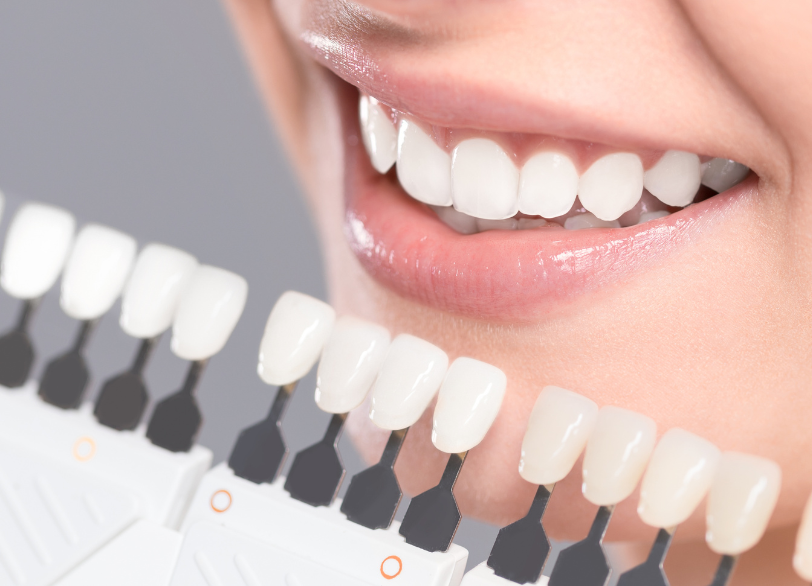 ホワイトニング|湘南パーク歯科