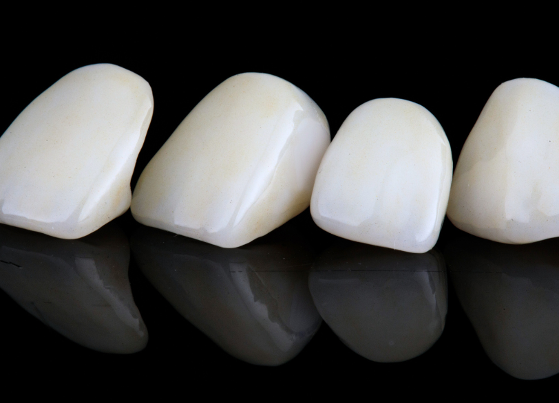 オールセラミッククラウン(e.max)|湘南パーク歯科