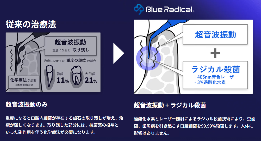 “ブルーラジカルとは|湘南パーク歯科"