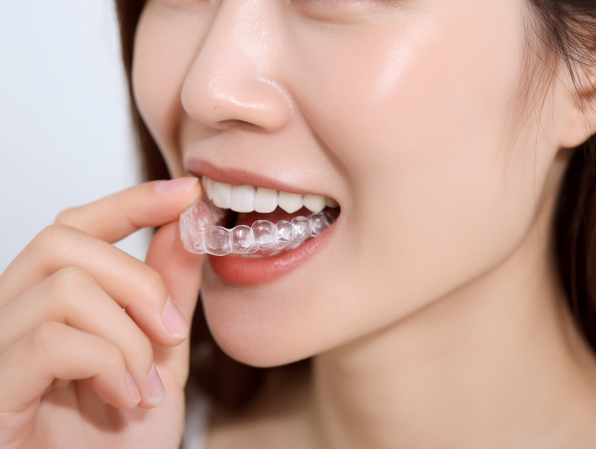 女性がマウスピースを装着する様子