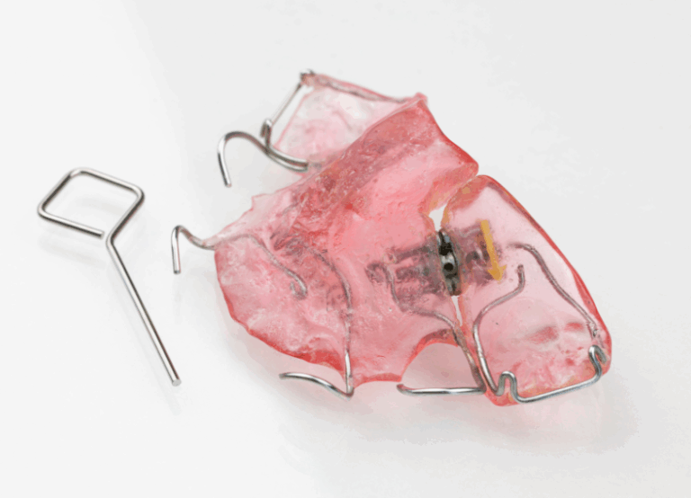 “床矯正|湘南パーク歯科"