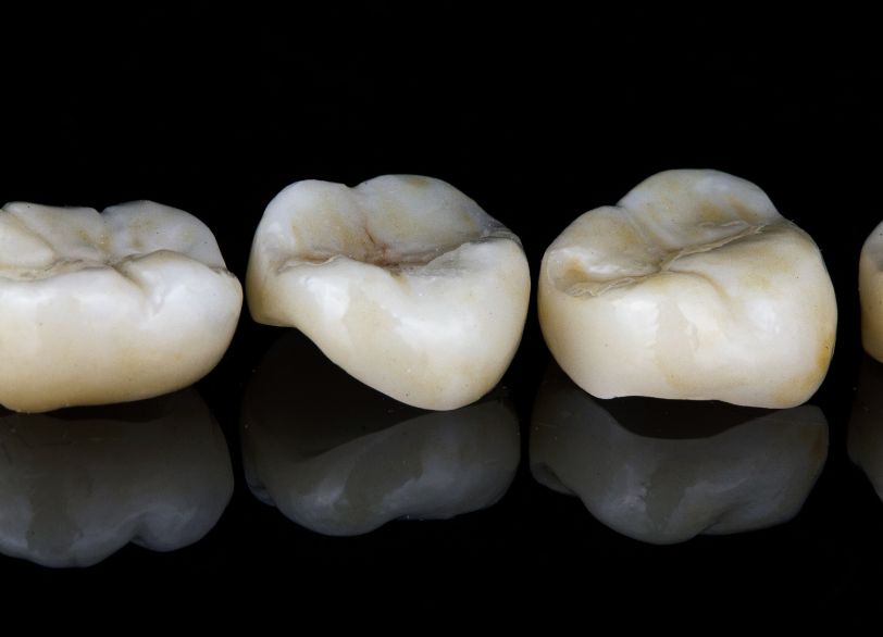 ジルコニアクラウン|湘南パーク歯科