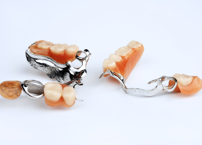 金属床義歯｜湘南パーク歯科