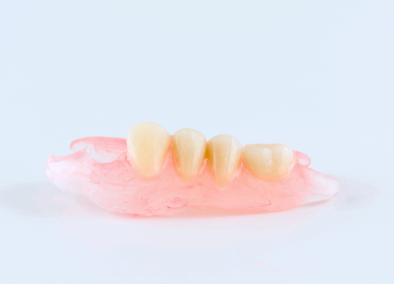 ノンクラスプデンチャー｜湘南パーク歯科