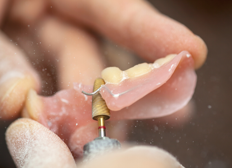 当院の入れ歯治療のこだわり｜湘南パーク歯科