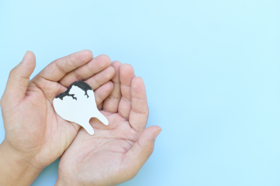 虫歯になる原因を断ち、未来の健康を守る