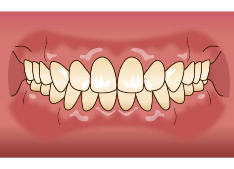 正しい噛み合わせ|湘南パーク歯科