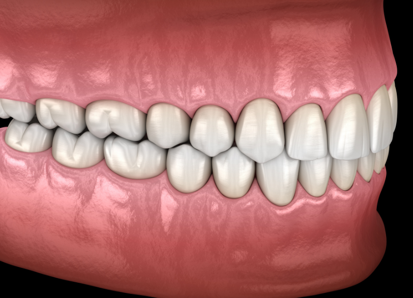全身の健康を支える「噛み合わせ」の重要性|湘南パーク歯科
