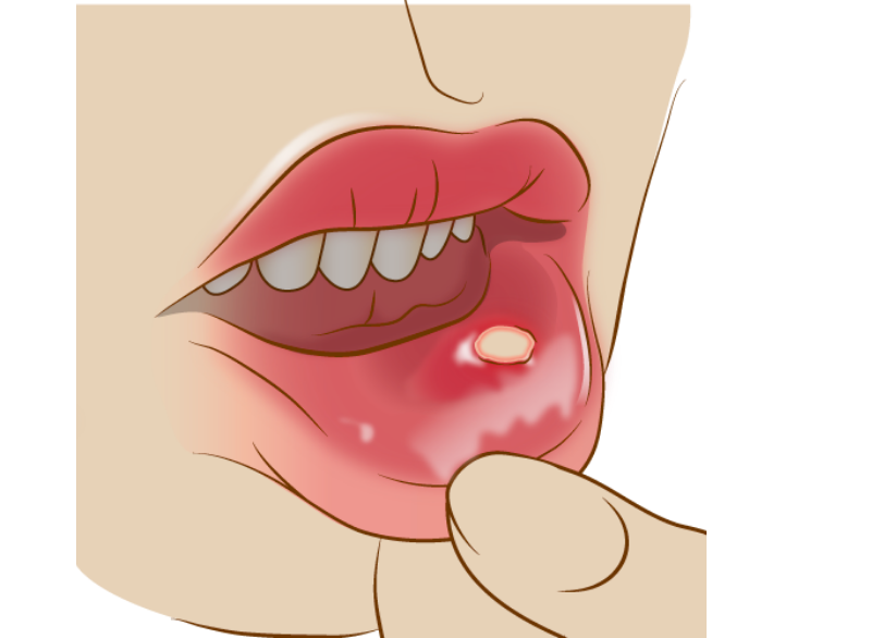 その他のお口のトラブル|湘南パーク歯科