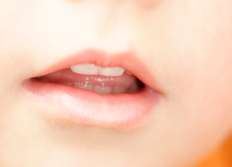 根本原因にアプローチするMFT(口腔筋機能療法)|湘南パーク歯科