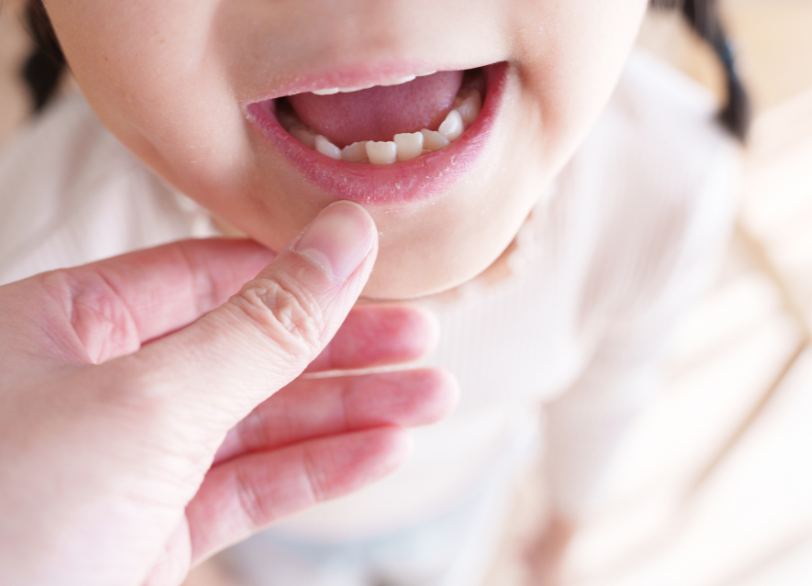 お子様の成長する力を利用した「予防矯正」|湘南パーク歯科