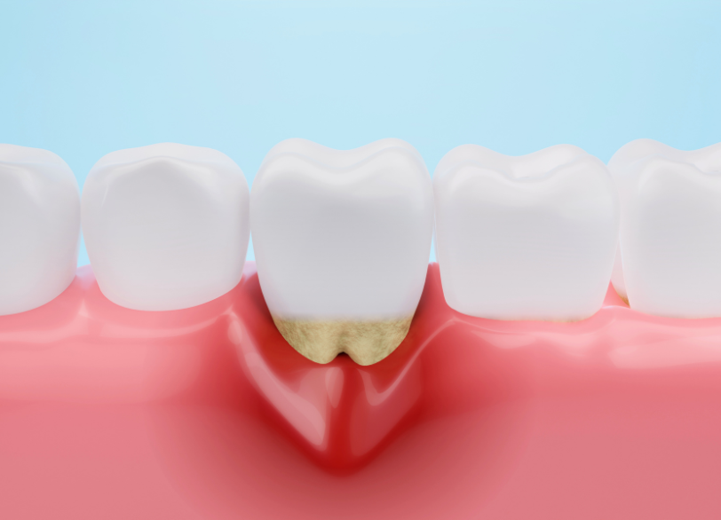 見逃してはいけない危険信号