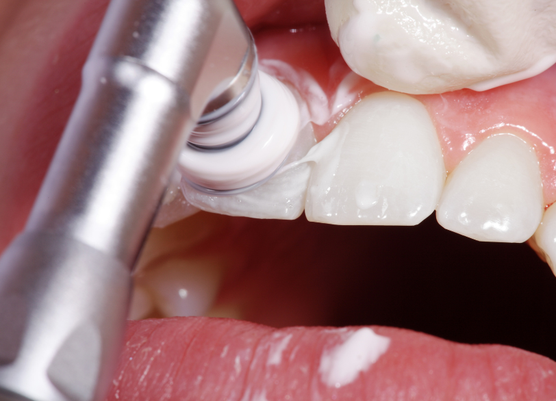 予防こそがいちばん大切な治療|湘南パーク歯科