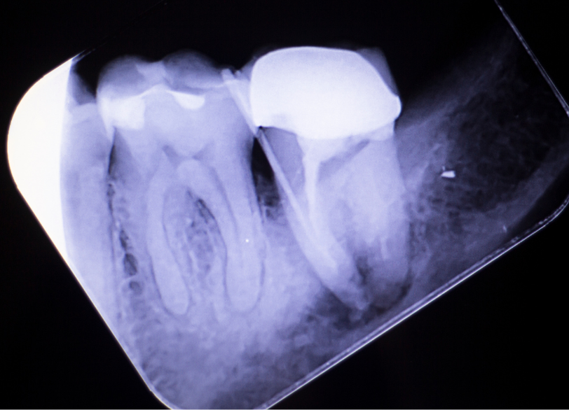 治療の流れ|湘南パーク歯科