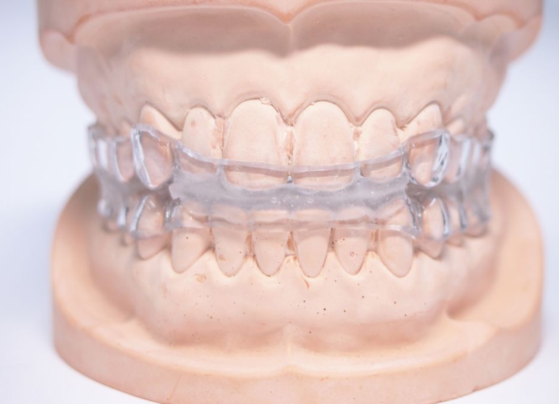 SASマウスピース|湘南パーク歯科